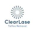 ClearLase Tattoo Removal-clearlasetattooremoval