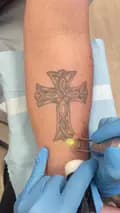ClearLase Tattoo Removal-clearlasetattooremoval